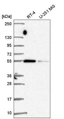 Western Blot SRP54 Antibody