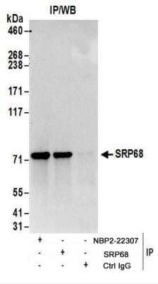 Immunoprecipitation: SRP68 Antibody [NBP2-22307] - Whole cell lysate (1 mg for IP; 20% of IP loaded) from HeLa cells.  NBP2-22307 used for IP at 6 ug/mg lysate.  SRP68 was also immunoprecipitated by rabbit anti-SRP68 antibody.  For blotting immunoprecipitated SRP68, NBP2-22307 was used at 0.4 ug/ml.  Detection: Chemiluminescence with an exposure time of 10 seconds.