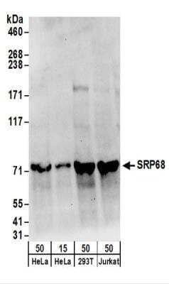 <b>Biological Strategies Validation. </b>Western Blot: SRP68 Antibody [NBP2-22307] - Whole cell lysate from HeLa (15 and 50 ug), 293T (50ug), and Jurkat (50ug) cells.  NBP2-22307 used for WB at 0.1 ug/ml.  Detection: Chemiluminescence with an exposure time of 30 seconds.