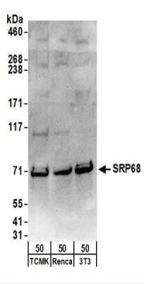 Western Blot: SRP68 Antibody [NBP2-22307] - Whole cell lysate (50 ug) from TCMK-1, Renca, and NIH3T3 cells.  NBP2-22307 used for WB at 0.1 ug/ml.  Detection: Chemiluminescence with an exposure time of 30 seconds.