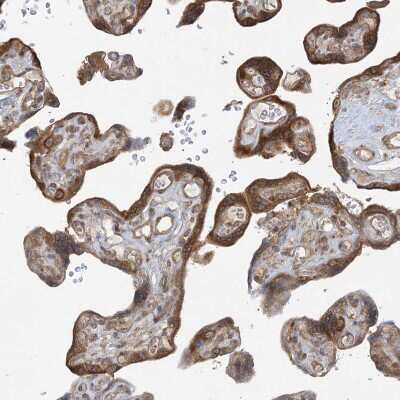 Immunohistochemistry-Paraffin: SRP72 Antibody [NBP1-89498] - Staining of human placenta shows moderate  cytoplasmic positivity in trophoblastic cells.