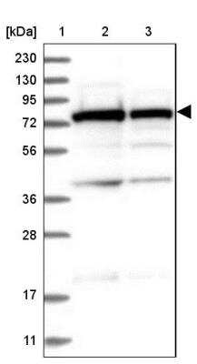 Western Blot: SRP72 Antibody [NBP1-89498] - Lane 1: Marker  [kDa] 230, 130, 95, 72, 56, 36, 28, 17, 11.  Lane 2: Human cell line RT-4.  Lane 3: Human cell line U-251MG sp