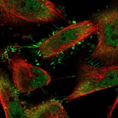 Immunocytochemistry/Immunofluorescence: SRPK1 Antibody [NBP2-58538] - Staining of human cell line U-251 MG shows localization to nucleoplasm, plasma membrane & cytosol.