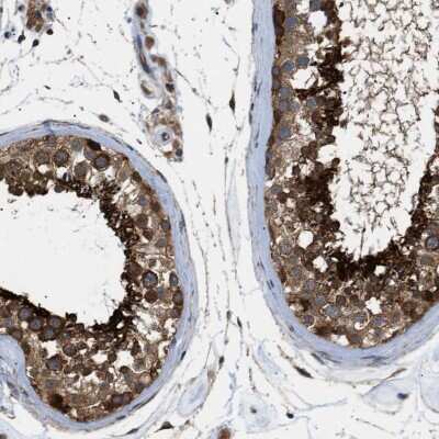 Immunohistochemistry-Paraffin: SRPK1 Antibody [NBP1-87050] - Staining of human testis shows strong cytoplasmic  positivity in cells in seminiferous ducts.