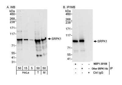 Western Blot: SRPK1 Antibody [NBP1-30108] - Detection of human and mouse SRPK1 by western blot (h & m) and immunoprecipitation (h). Samples: Whole cell lysate from HeLa (5, 15 and 50 ug for WB; 1 mg for IP, 20% of IP loaded), HEK293T (T; 50 ug), and mouse NIH 3T3 (M; 50 ug) cells. Antibodies: Affinity purified rabbit anti-SRPK1 antibody NBP1-30108 used for WB at 0.04 ug/ml (A) and 1 ug/ml (B) and used for IP at 3 ug/mg lysate. SRPK1 was also immunoprecipitated by another rabbit anti-SRPK1 antibody, which recognizes a downstream epitope. Detection: Chemiluminescence with exposure times of 10 seconds (A) and 3 seconds (B).