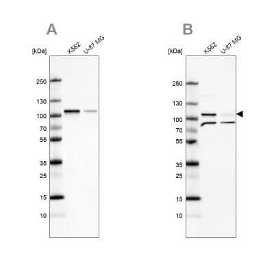 <b>Independent Antibodies Validation. </b>Western Blot: SRPK1 Antibody [NBP1-87050] - Analysis using Anti-SRPK1 antibody NBP1-87050 (A) shows similar pattern to independent antibody NBP2-58538 (B).