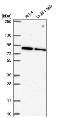 Western Blot: SRPK1 Antibody [NBP2-58538] - Western blot analysis in human cell line RT-4 and human cell line U-251 MG.