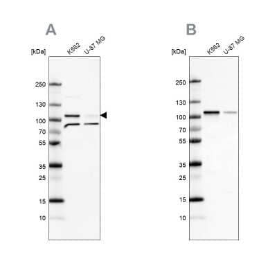 <b>Independent Antibodies Validation. </b>Western Blot: SRPK1 Antibody [NBP2-58538] - Analysis using Anti-SRPK1 antibody NBP2-58538 (A) shows similar pattern to independent antibody NBP1-87050 (B).