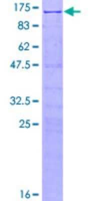 SDS-PAGE Recombinant Human SRPK1 GST (N-Term) Protein