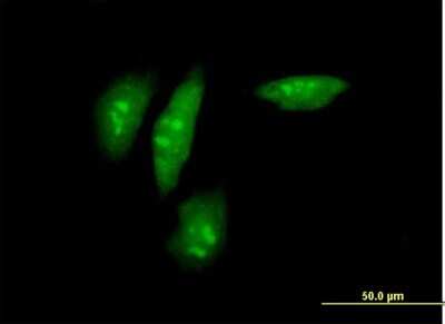 Immunocytochemistry/Immunofluorescence: SRPK2 Antibody [H00006733-B01P] - Analysis of purified antibody to SRPK2 on HeLa cell. (antibody concentration 10 ug/ml)