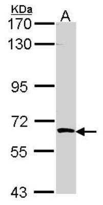 Western Blot SRPK3/STK23 Antibody - BSA Free