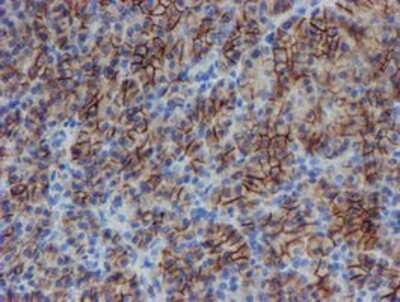 Immunohistochemistry-Paraffin: SRPRB Antibody (1D9) [NBP2-02028] - Staining of paraffin-embedded Human pancreas tissue using anti-SRPRB mouse monoclonal antibody.