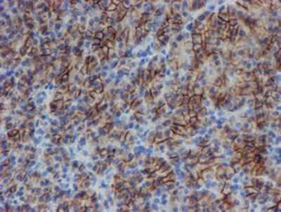 Immunohistochemistry: SRPRB Antibody (OTI1D9) - Azide and BSA Free [NBP2-74350] - Staining of paraffin-embedded Human pancreas tissue using anti-SRPRB mouse monoclonal antibody.