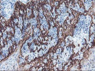 Immunohistochemistry: SRPRB Antibody (OTI1D9) - Azide and BSA Free [NBP2-74350] - Staining of paraffin-embedded Human tonsil using anti-SRPRB mouse monoclonal antibody.