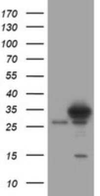 Western Blot: SRPRB Antibody (OTI2D4) - Azide and BSA Free [NBP2-74351] - Analysis of HEK293T cells were transfected with the pCMV6-ENTRY control (Left lane) or pCMV6-ENTRY SRPRB.