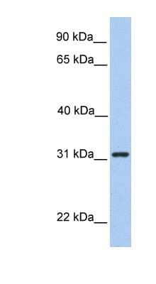 Western Blot: SRPRB Antibody [NBP1-59710] - Hela cell lysate, concentration 0.2-1 ug/ml.