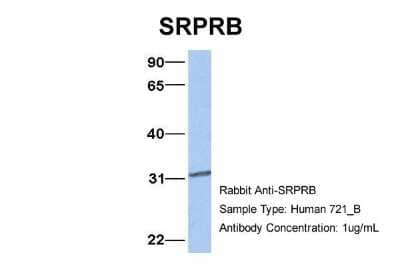 Western Blot: SRPRB Antibody [NBP1-59710] - Analysis of 721_B cell lysate. Antibody Dilution: 1.0 ug/ml SRPRB is supported by BioGPS gene expression data to be expressed in 721_B.