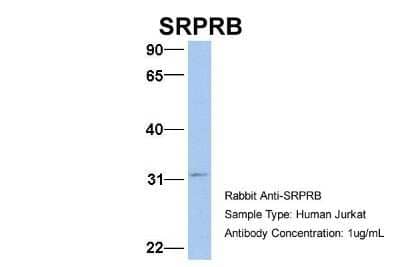Western Blot: SRPRB Antibody [NBP1-59710] - Jurkat, Antibody Dilution: 1.0 ug/ml SRPRB is supported by BioGPS gene expression data to be expressed in Jurkat.