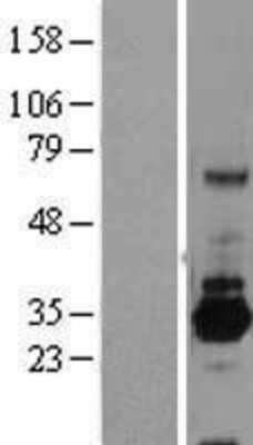 Western Blot: SRPRB Overexpression Lysate (Adult Normal) [NBL1-16457] Left-Empty vector transfected control cell lysate (HEK293 cell lysate); Right -Over-expression Lysate for SRPRB.