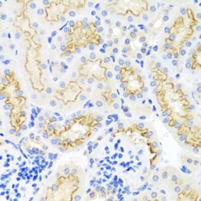 Immunohistochemistry-Paraffin: SRPX Antibody [NBP2-93855] - Paraffin-embedded mouse kidney using SRPX .