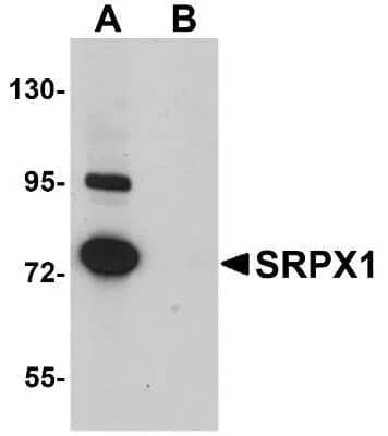 Western Blot SRPX Antibody Blocking Peptide