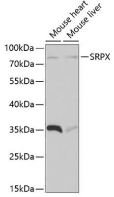 Western Blot: SRPX Antibody [NBP2-93855] - Analysis of extracts of various cell lines, using SRPX at 1:1000 dilution. Secondary antibody: HRP Goat Anti-Rabbit IgG (H+L) at 1:10000 dilution. Lysates/proteins: 25ug per lane. Blocking buffer: 3% nonfat dry milk in TBST.