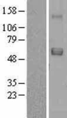 Western Blot: SRPX Overexpression Lysate (Adult Normal) [NBL1-16458] Left-Empty vector transfected control cell lysate (HEK293 cell lysate); Right -Over-expression Lysate for SRPX.