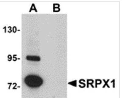 Western Blot: SRPX Peptide [NBP1-77086PEP] - blocks the antibody activity completely in Western blot by incubating the peptide with equal volume of antibody for 30 min at 37C.  