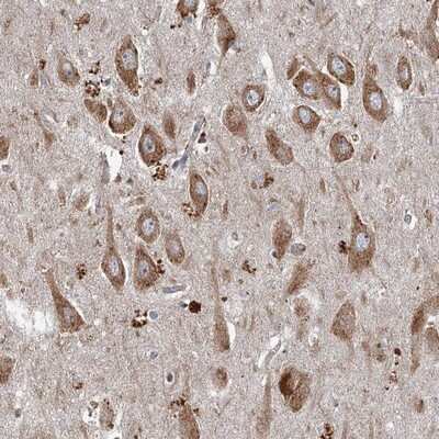 Immunohistochemistry-Paraffin: SRPX2 Antibody [NBP1-86999] - Staining of human hippocampus shows moderate cytoplasmic positivity in neuronal cells.