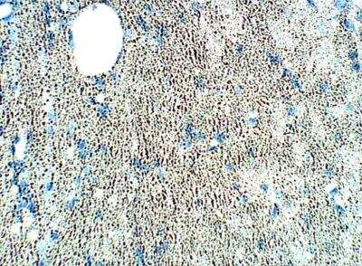 Immunohistochemistry-Paraffin: SRPX2 Antibody [NBP3-12352] - Rat Brain. 1:100 dilution in IHC blocking buffer. DAB (brown), staining and Hematoxylin QS (blue) counterstain. 40X magnification.