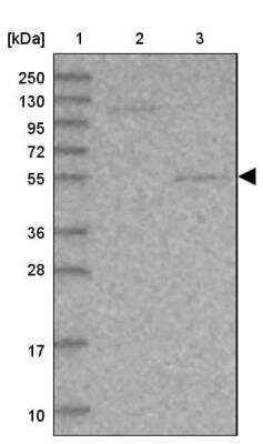 Western Blot: SRPX2 Antibody [NBP1-86999] - Lane 1: Marker  [kDa] 250, 130, 95, 72, 55, 36, 28, 17, 10.  Lane 2: Human cell line RT-4.  Lane 3: Human cell line U-251MG sp