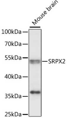 Western Blot: SRPX2 Antibody [NBP2-94774] - Analysis of extracts of mouse brain, using SRPX2 .Exposure time: 10s.