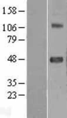 Western Blot: SRPX2 Overexpression Lysate (Adult Normal) [NBL1-16459] Left-Empty vector transfected control cell lysate (HEK293 cell lysate); Right -Over-expression Lysate for SRPX2.