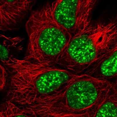 <b>Genetic Strategies Validation. </b>Immunocytochemistry/Immunofluorescence: SRRM1 Antibody [NBP2-57064] - Staining of human cell line HEK 293 shows localization to nuclear speckles.