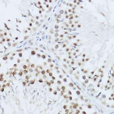 Immunohistochemistry-Paraffin: SRRM1 Antibody [NBP2-93715] - Immunohistochemistry of paraffin-embedded mouse testis using SRRM1 Rabbit pAb (NBP2-93715) at dilution of 1:450 (40x lens). Perform high pressure antigen retrieval with 10 mM citrate buffer pH 6.0 before commencing with IHC staining protocol.