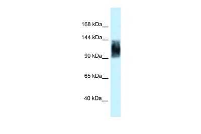 Western Blot: SRRM1 Antibody [NBP2-85821] - WB Suggested Anti-Srrm1 Antibody. Titration: 1.0 ug/ml. Positive Control: Rat Brain