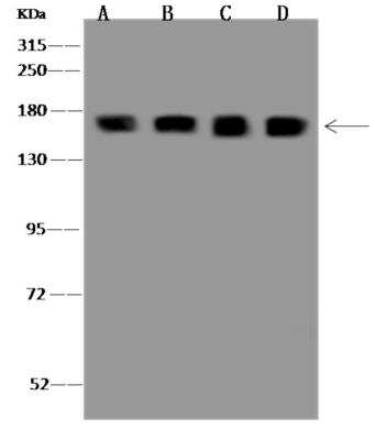 Western Blot: SRRM1 Antibody [NBP3-06341] - Anti-SRRM1 rabbit polyclonal antibody at 1:500 dilutionLane A: U937 Whole Cell LysateLane B: Daudi Whole Cell LysateLane C: K562 Whole Cell LysateLane D: HL60 Whole Cell LysateLysates/proteins at 30 ug per lane.SecondaryGoat Anti-Rabbit IgG (H+L) HRP at 110000 dilution.Developed using the ECL technique.Performed under reducing conditions.Predicted band size:102 kDaObserved band size:165 kDa