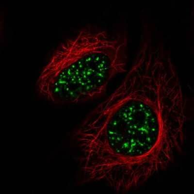 Immunocytochemistry/Immunofluorescence: SRRM2 Antibody [NBP2-55697] - Staining of human cell line HeLa shows localization to nuclear speckles.  Antibody staining is shown in green.