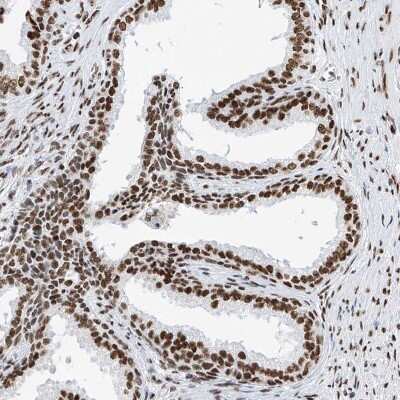 Immunohistochemistry-Paraffin: SRp55 Antibody [NBP1-90043] - Staining of human prostate shows moderate to strong nuclear positivity in glandular cells.