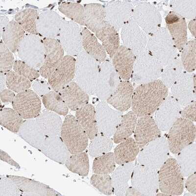 Immunohistochemistry-Paraffin: SRp55 Antibody [NBP1-90043] - Staining of human skeletal muscle shows moderate nuclear positivity in myocytes.