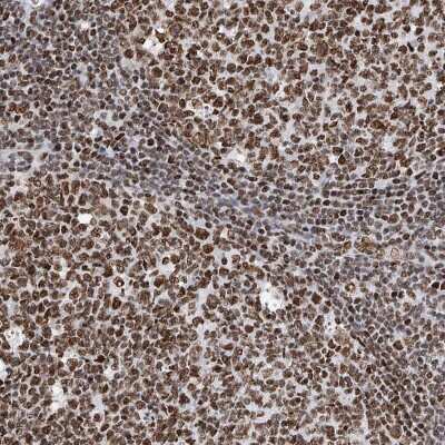 Immunohistochemistry-Paraffin: SRp55 Antibody [NBP1-90043] - Staining of human tonsil shows moderate to strong nuclear positivity.