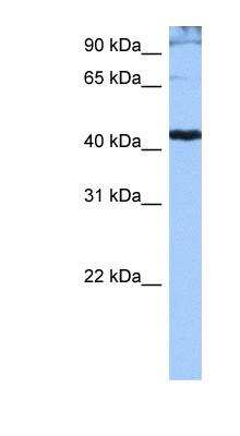 Western Blot: SRp55 Antibody [NBP1-57112] - Jurkat cell lysate, concentration 0.2-1 ug/ml.