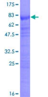 SDS-Page: SRp55 Recombinant Protein [H00006431-P01]