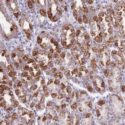 Immunohistochemistry-Paraffin: SS18L2 Antibody [NBP2-13386] - Staining of human stomach, lower shows strong cytoplasmic positivity in glandular cells.