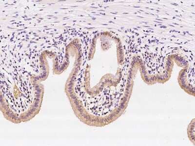 Immunohistochemistry-Paraffin: SS18L2 Antibody [NBP2-98477] - Immunochemical staining of human SS18L2 in human gallbladder with rabbit polyclonal antibody at 1:100 dilution, formalin-fixed paraffin embedded sections.