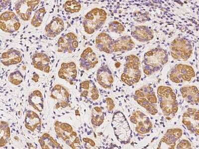 Immunohistochemistry-Paraffin: SS18L2 Antibody [NBP2-98477] - Immunochemical staining of human SS18L2 in human stomach with rabbit polyclonal antibody at 1:100 dilution, formalin-fixed paraffin embedded sections.