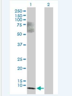 Western Blot: SS18L2 Antibody [H00051188-B04P-50ug] - Analysis of SS18L2 expression in transfected 293T cell line (H00051188-T03) by SS18L2 MaxPab polyclonal antibody.  Lane 1: SS18L2 transfected lysate(8.47 KDa). Lane 2: Non-transfected lysate.