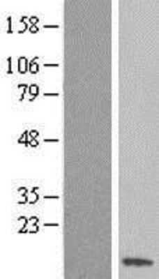 Western Blot: SS18L2 Overexpression Lysate (Adult Normal) [NBL1-16463] Left-Empty vector transfected control cell lysate (HEK293 cell lysate); Right -Over-expression Lysate for SS18L2.