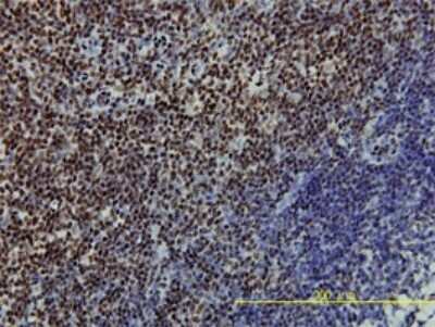 Immunohistochemistry-Paraffin: SSB Antibody (1D6-H5) [H00006741-M01] - Analysis of monoclonal antibody to SSB on formalin-fixed paraffin-embedded human tonsil tissue. Antibody concentration 5 ug/ml.