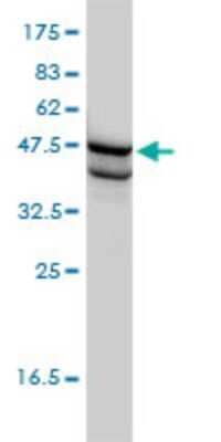 Western Blot: SSB Antibody (1D6-H5) [H00006741-M01] - SSB monoclonal antibody (M01), clone 1D6-H5 Analysis of SSB expression in HL-60.